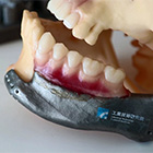 The 3D-printed prosthetic jaw co-developed by ITRI and KSVGH.